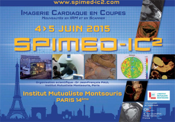 SPIMED L’Imagerie Cardiaque en Coupes (IC2)