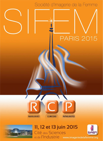 SIFEM