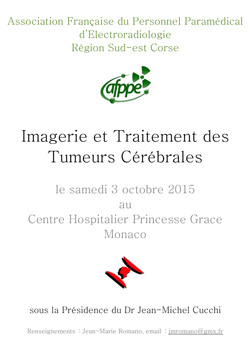 Imagerie et Traitement des Tumeurs Cérébrales