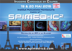 SPIMED L’Imagerie Cardiaque en Coupes (IC2)