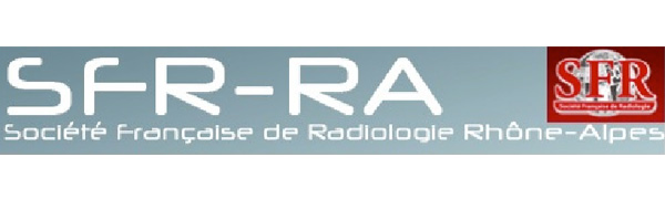 SFR-RA